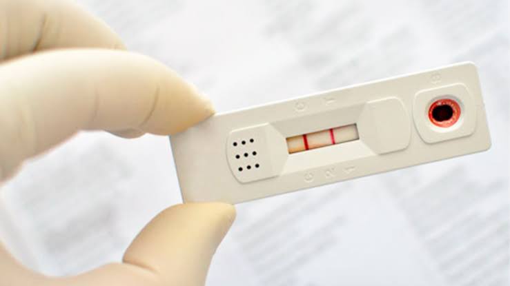 Com afrouxamento no isolamento social, casos de Coronavirus aumenta 