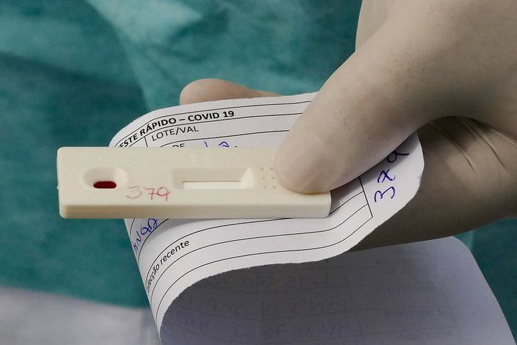 Em meio a explosão de casos de gripe, postos de saúde disponibilizam testes rápidos de Covid-19