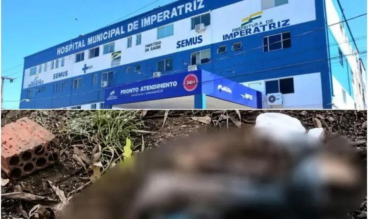 Perna encontrada às margens da BR-010 pode ter relação com freezer furtado do Socorrão, afirma polícia 